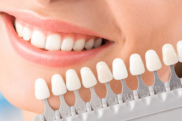 ¿Hay algún efecto secundario del blanqueamiento dental? No conoces estos tres puntos.